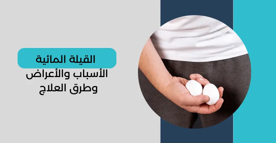 القيلة المائية أسباب القيلة المائية أعراض القيلة المائية علاج القيلة المائية