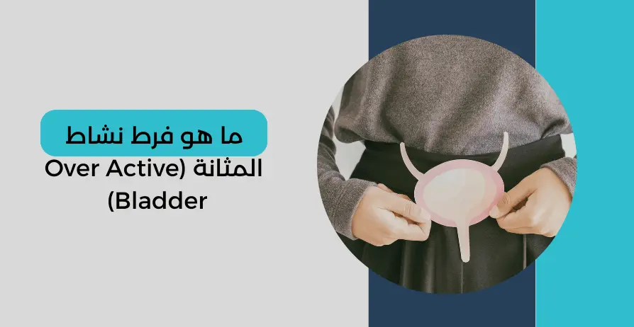 فرط نشاط المثانة