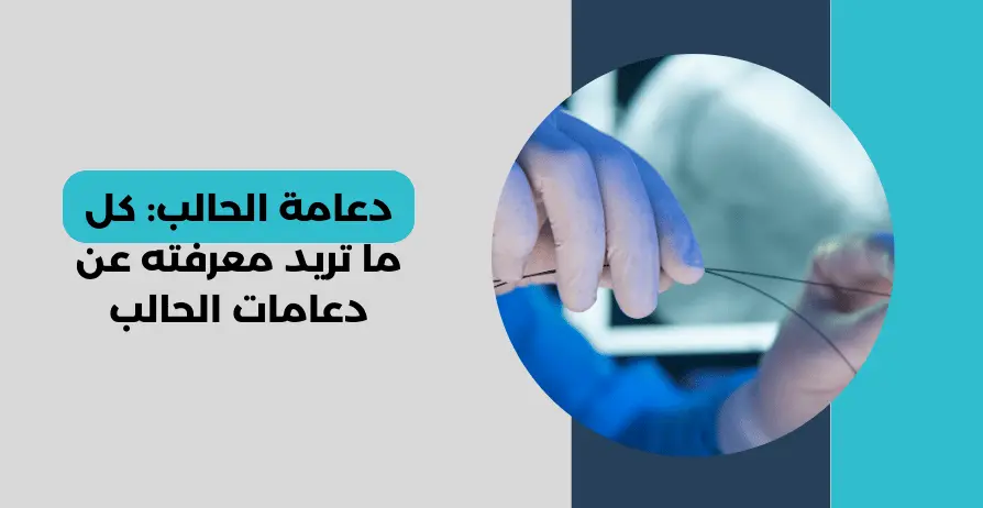 دعامة الحالب تركيب دعامة الحالب عملية دعامة الحالب عملية ازالة دعامة الحالب